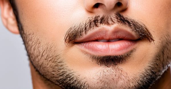 Épilation laser du visage : les secrets d'une peau parfaite